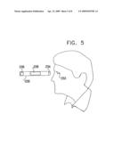 LONG-TERM SPG STIMULATION THERAPY FOR PREVENTION OF VASCULAR DEMENTIA diagram and image