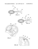 MINIATURE WIRELESS SYSTEM FOR DEEP BRAIN STIMULATION diagram and image