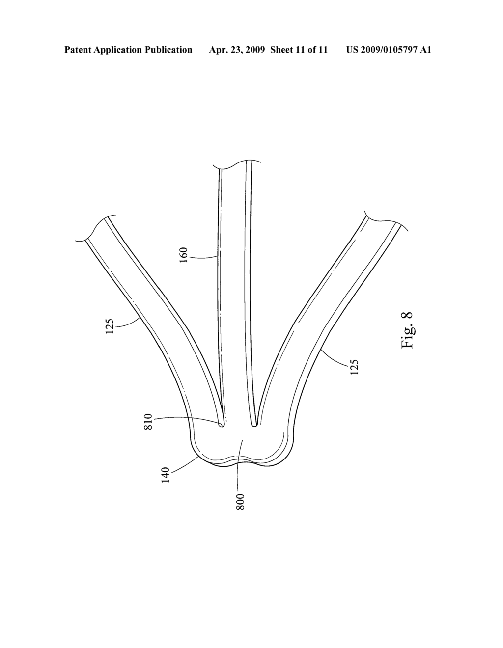 EXPANDABLE STENT - diagram, schematic, and image 12