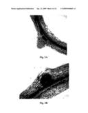 Systemic non-nodular endosymbiotic nitrogen fixation in plants diagram and image