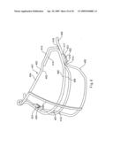 Helmet with an attachment mechanism for a faceguard diagram and image