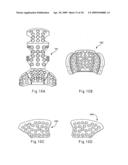 Helmet with an attachment mechanism for a faceguard diagram and image