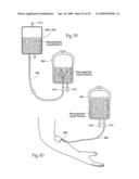 Apparatus and methods for making, storing, and administering freeze-dried materials such as freeze-dried plasma diagram and image