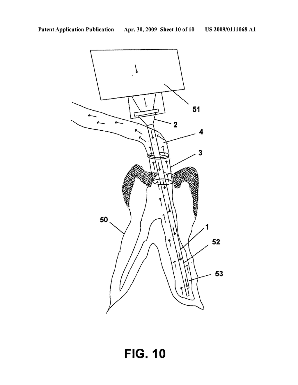 Irrigation and Aspiration Device - diagram, schematic, and image 11