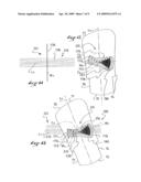 ASSEMBLY FOR PRACTICING A GLIDING OR ROLLING SPORT diagram and image