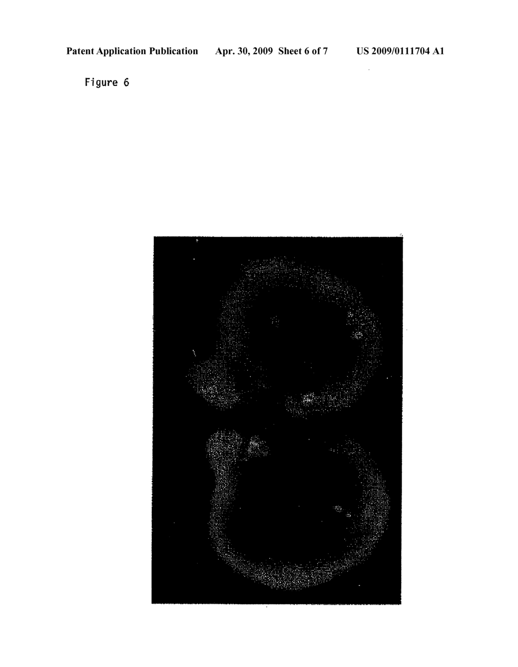 PANEL FOR THE DETECTION AND DIFFERENTIATION OF RENAL CORTICAL NEOPLASMS - diagram, schematic, and image 07