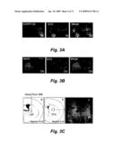 FIBROBLAST GROWTH FACTOR-2 PROMOTES NEUROGENESIS AND NEUROPROTECTION AND PROLONGS SURVIVAL IN HUNTINGTON S DISEASE diagram and image