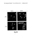 FIBROBLAST GROWTH FACTOR-2 PROMOTES NEUROGENESIS AND NEUROPROTECTION AND PROLONGS SURVIVAL IN HUNTINGTON S DISEASE diagram and image