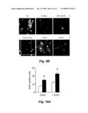 FIBROBLAST GROWTH FACTOR-2 PROMOTES NEUROGENESIS AND NEUROPROTECTION AND PROLONGS SURVIVAL IN HUNTINGTON S DISEASE diagram and image