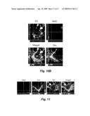 FIBROBLAST GROWTH FACTOR-2 PROMOTES NEUROGENESIS AND NEUROPROTECTION AND PROLONGS SURVIVAL IN HUNTINGTON S DISEASE diagram and image