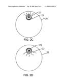 Brachytherapy Apparatus and Method Using Rotating Radiation Source diagram and image