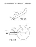 Brachytherapy Apparatus and Method Using Rotating Radiation Source diagram and image