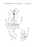 Brachytherapy apparatus and method for use with minimally invasive surgeries of the lung diagram and image