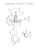 Brachytherapy apparatus and method for use with minimally invasive surgeries of the lung diagram and image