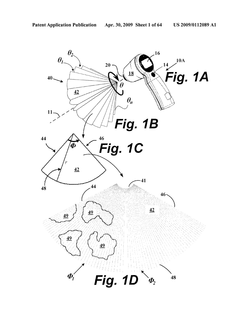 SYSTEM AND METHOD FOR MEASURING BLADDER WALL THICKNESS AND PRESENTING A BLADDER VIRTUAL IMAGE - diagram, schematic, and image 02