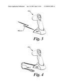 SYSTEM AND METHOD FOR MEASURING BLADDER WALL THICKNESS AND PRESENTING A BLADDER VIRTUAL IMAGE diagram and image