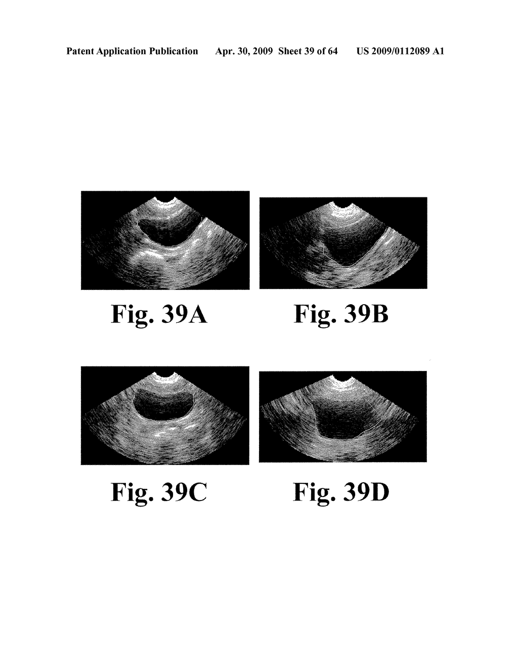 SYSTEM AND METHOD FOR MEASURING BLADDER WALL THICKNESS AND PRESENTING A BLADDER VIRTUAL IMAGE - diagram, schematic, and image 40