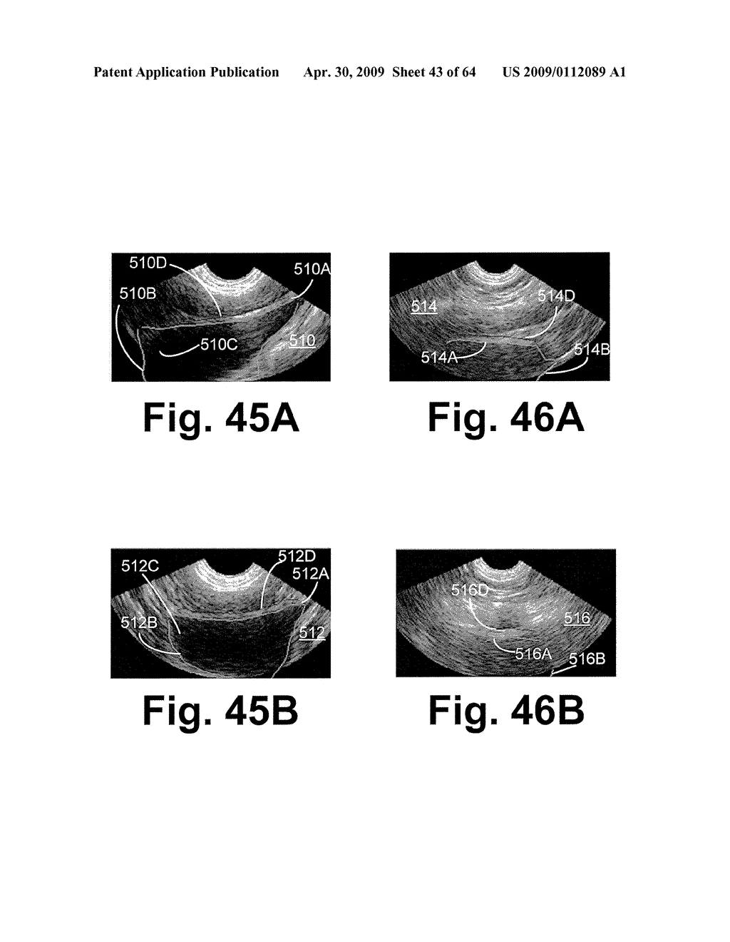 SYSTEM AND METHOD FOR MEASURING BLADDER WALL THICKNESS AND PRESENTING A BLADDER VIRTUAL IMAGE - diagram, schematic, and image 44