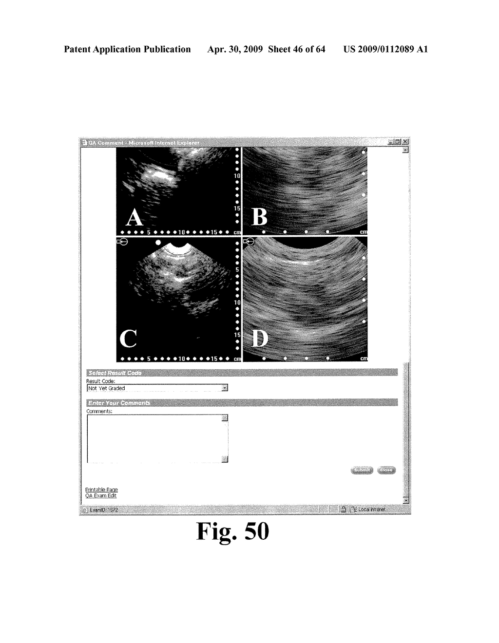 SYSTEM AND METHOD FOR MEASURING BLADDER WALL THICKNESS AND PRESENTING A BLADDER VIRTUAL IMAGE - diagram, schematic, and image 47