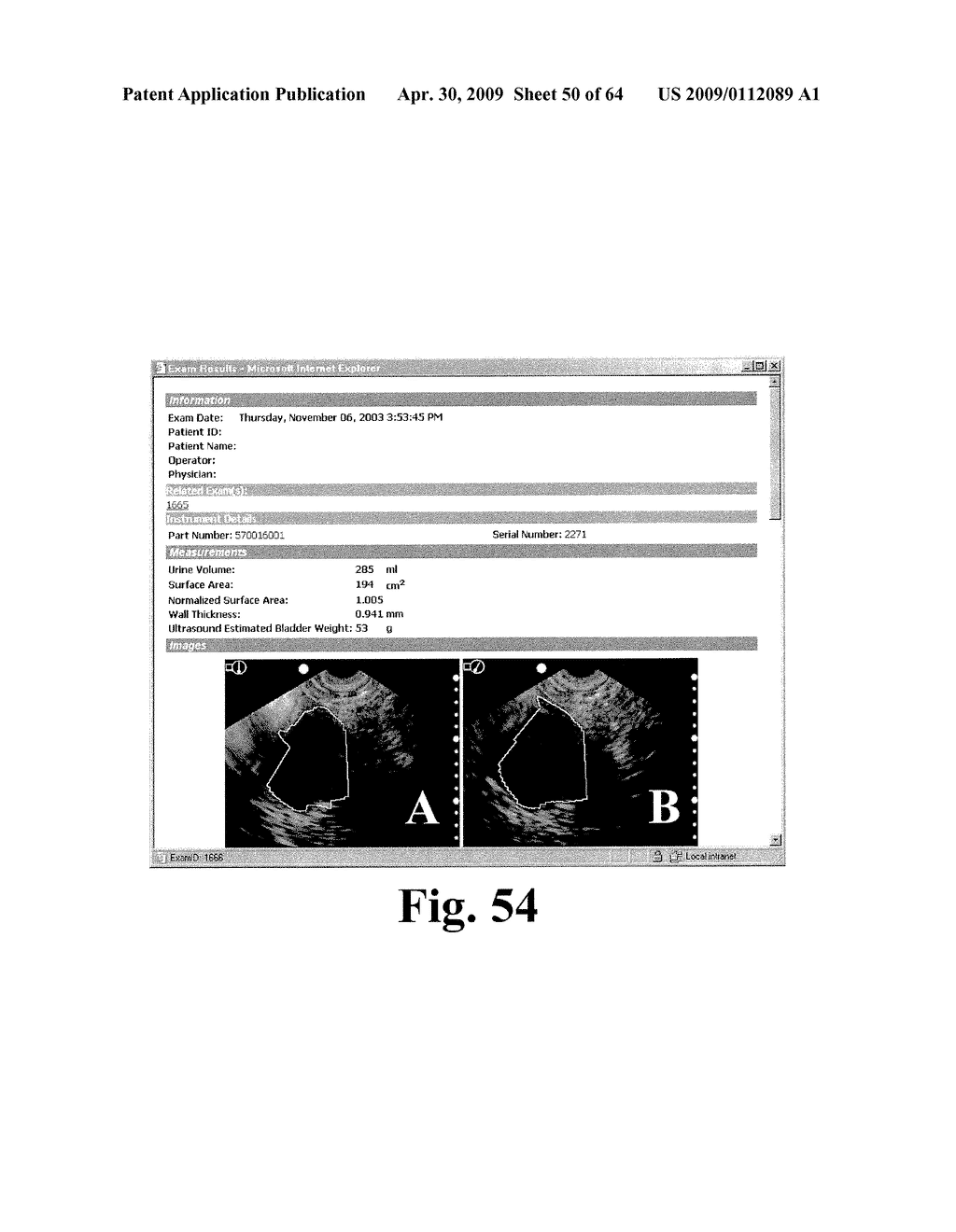 SYSTEM AND METHOD FOR MEASURING BLADDER WALL THICKNESS AND PRESENTING A BLADDER VIRTUAL IMAGE - diagram, schematic, and image 51