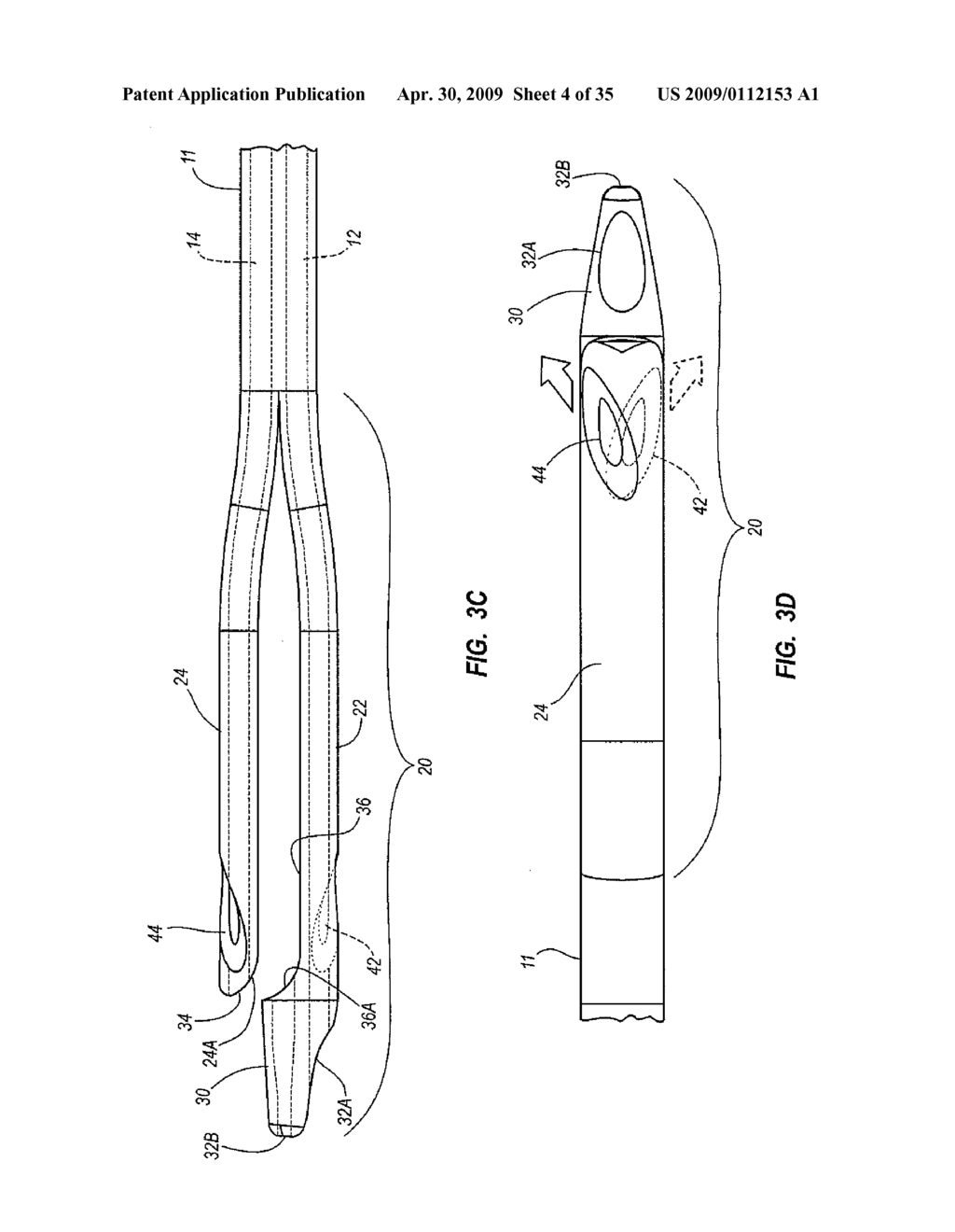 SPLIT-TIP CATHETER INCLUDING LATERAL DISTAL OPENINGS - diagram, schematic, and image 05