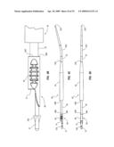 SPLIT-TIP CATHETER INCLUDING LATERAL DISTAL OPENINGS diagram and image