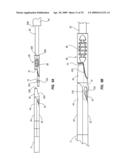 SPLIT-TIP CATHETER INCLUDING LATERAL DISTAL OPENINGS diagram and image