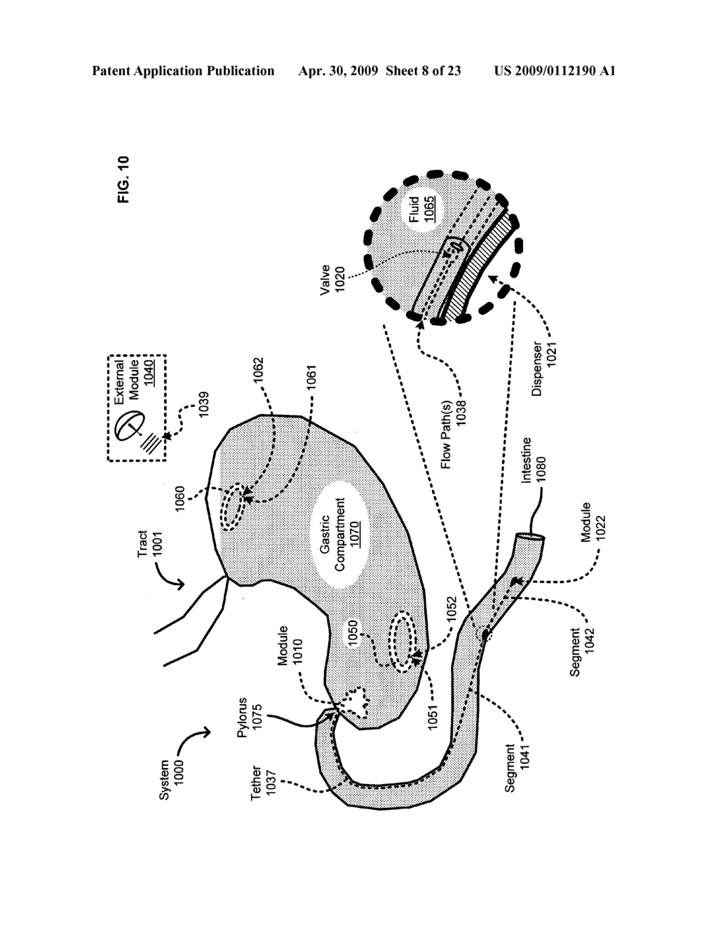 Medical or veterinary digestive tract utilization systems and methods - diagram, schematic, and image 09