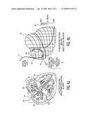 EP SIGNAL MAPPING-BASED OPTICAL ABLATION FOR PATIENT MONITORING AND MEDICAL APPLICATIONS diagram and image