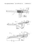 Tenaculum Stabilizer Device diagram and image