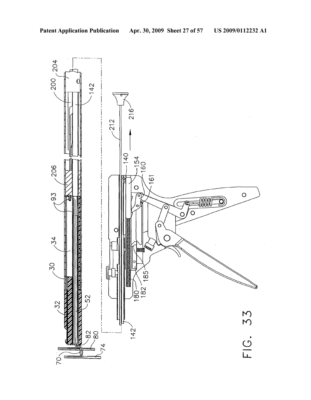 Method for Deploying A Device For Gastric Volume Reduction - diagram, schematic, and image 28