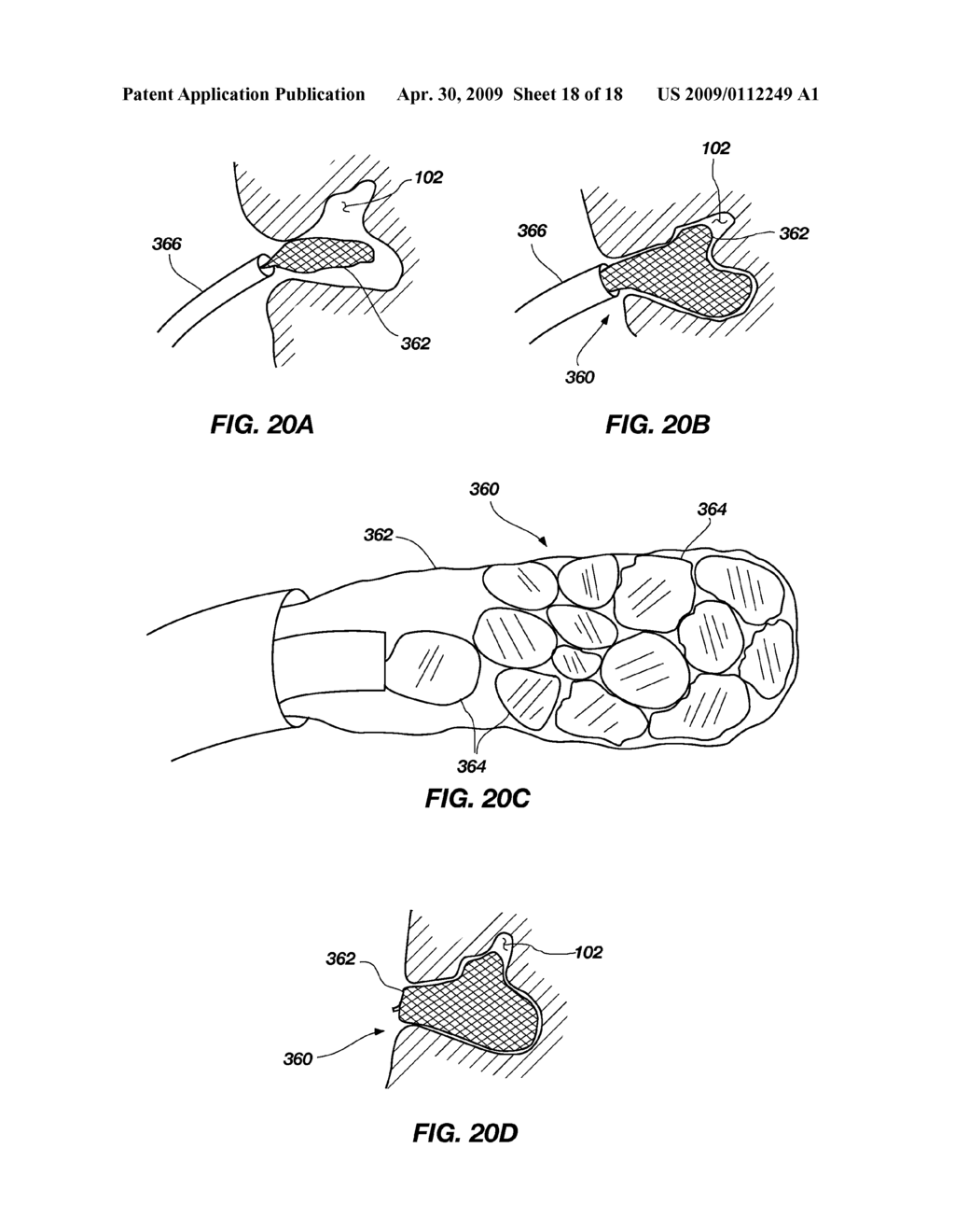 MEDICAL DEVICE FOR MODIFICATION OF LEFT ATRIAL APPENDAGE AND RELATED SYSTEMS AND METHODS - diagram, schematic, and image 19
