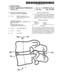 DEVICES AND METHODS FOR THE TREATMENT OF SPINAL DISORDERS diagram and image