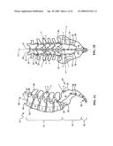 DEVICES AND METHODS FOR THE TREATMENT OF SPINAL DISORDERS diagram and image