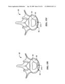 DEVICES AND METHODS FOR THE TREATMENT OF SPINAL DISORDERS diagram and image