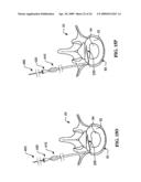 DEVICES AND METHODS FOR THE TREATMENT OF SPINAL DISORDERS diagram and image