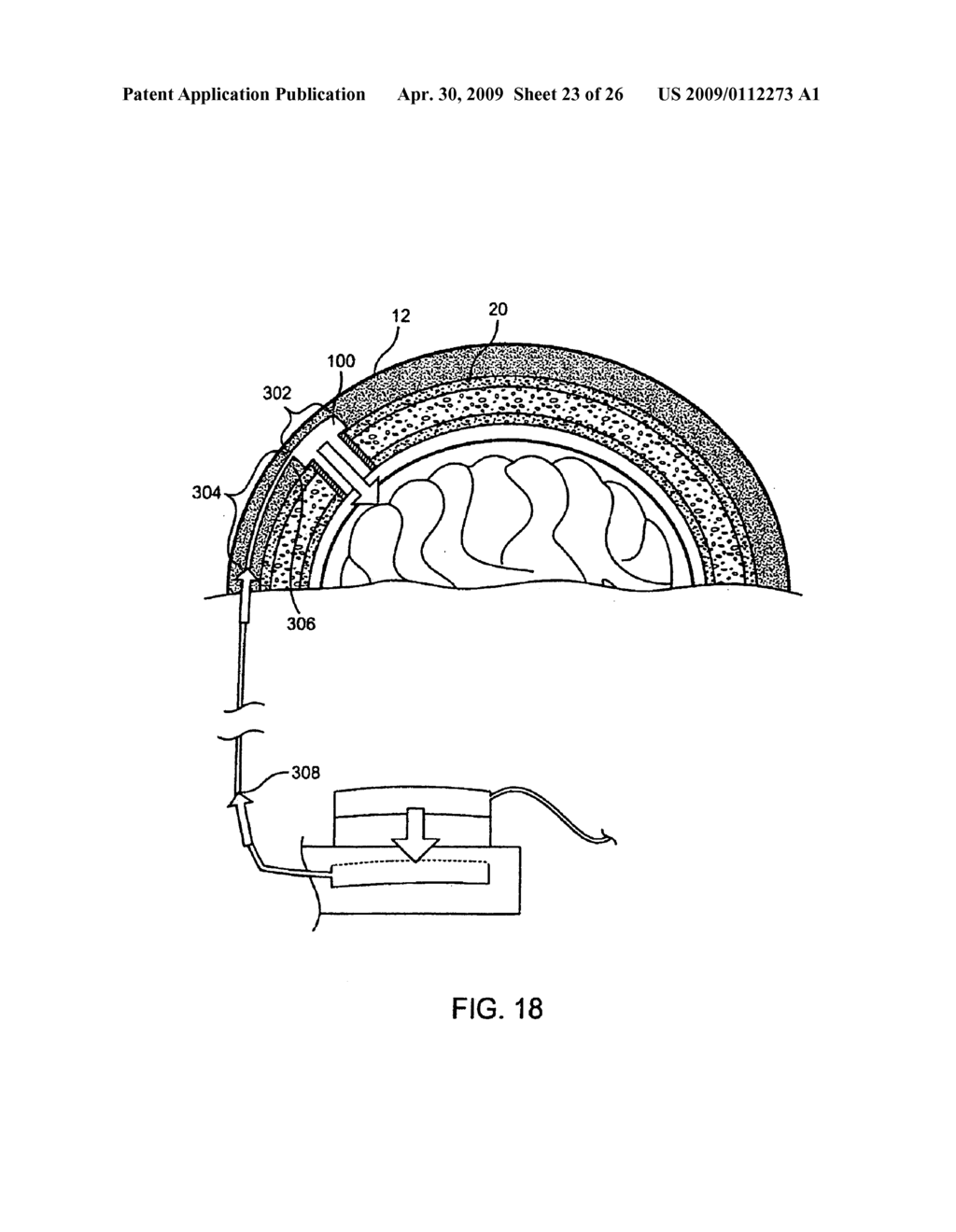 SYSTEMS, METHODS AND DEVICES FOR A SKULL/BRAIN INTERFACE - diagram, schematic, and image 24