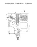 Strain Relief System For Spinal Cord Stimulation Lead diagram and image