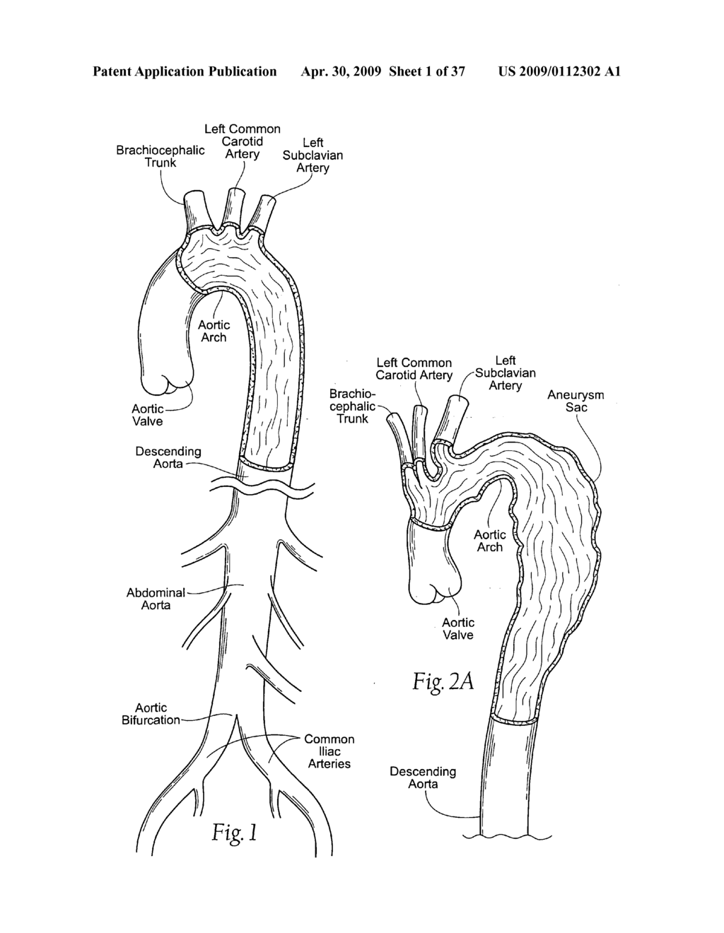 Devices, systems, and methods for endovascular staple and/or prosthesis delivery and implantation - diagram, schematic, and image 02