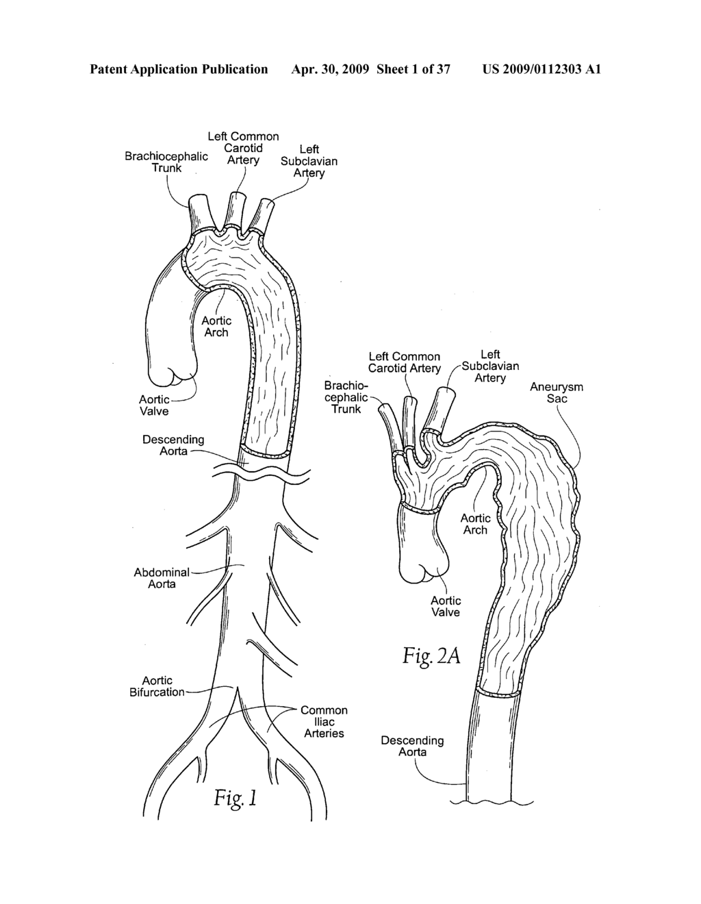 Devices, systems, and methods for endovascular staple and/or prosthesis delivery and implantation - diagram, schematic, and image 02