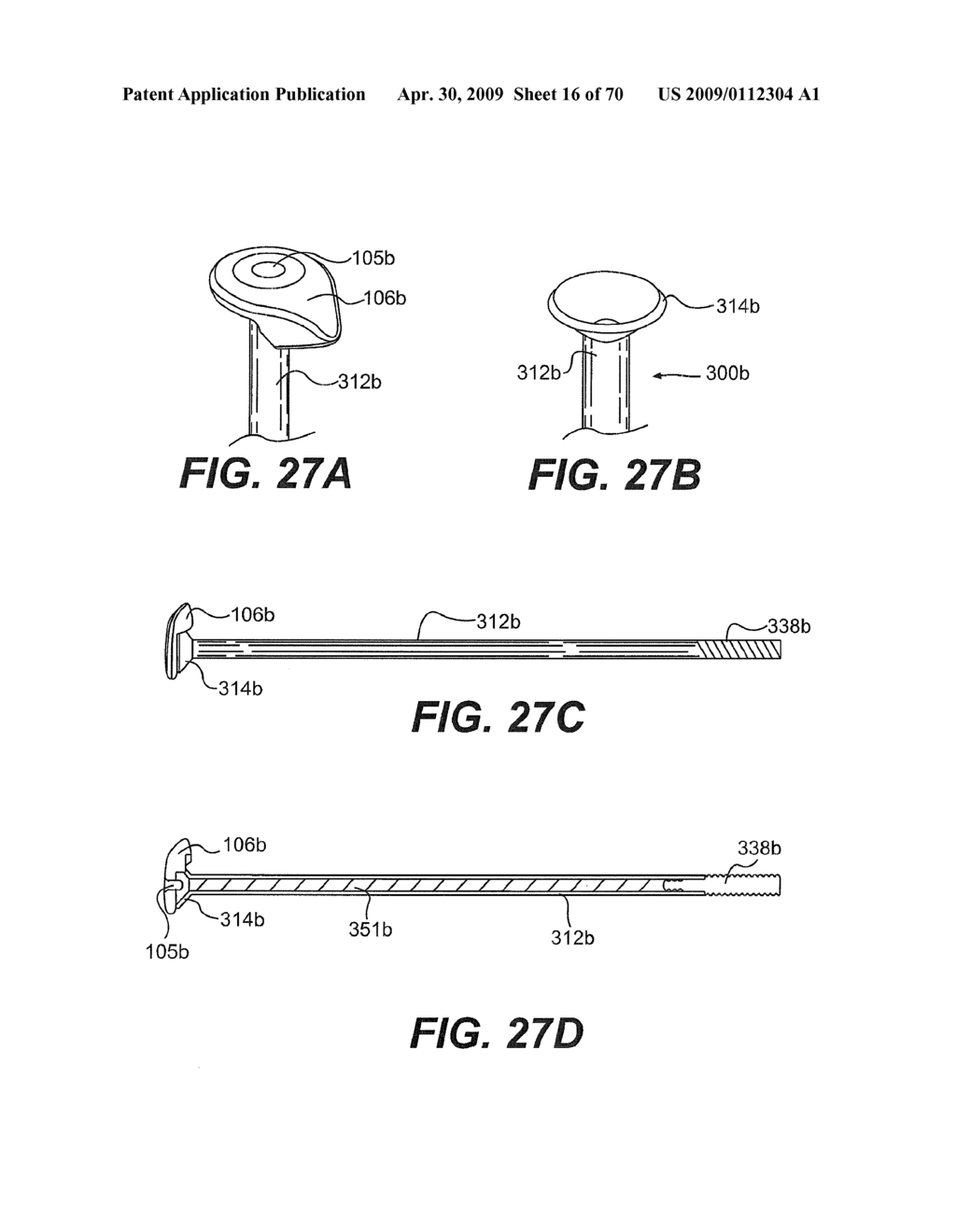 METHOD FOR PERFORMING A VASCULAR ANASTOMOSIS - diagram, schematic, and image 17