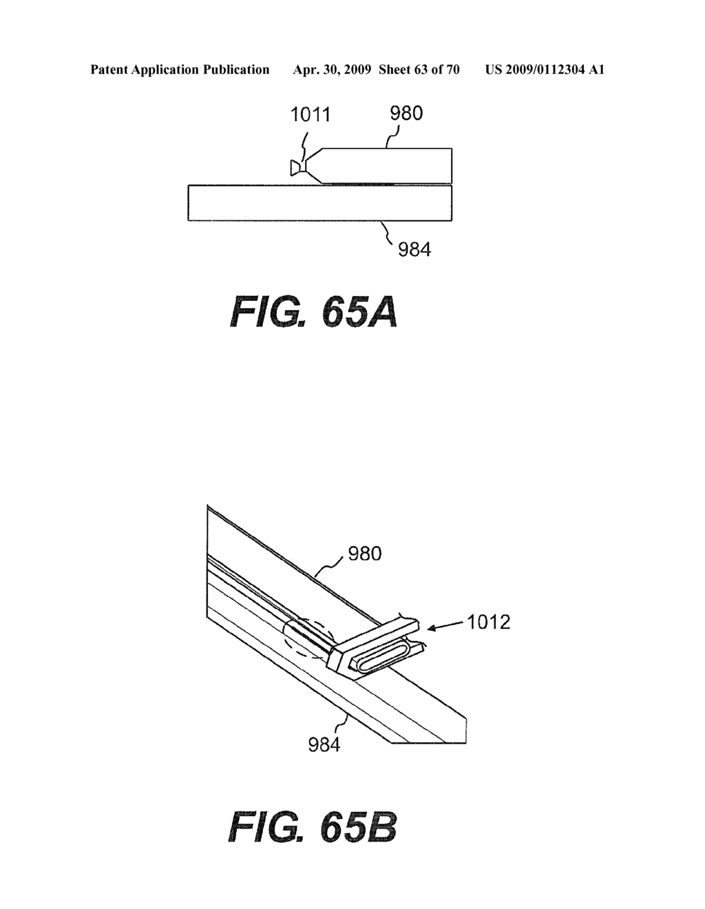 METHOD FOR PERFORMING A VASCULAR ANASTOMOSIS - diagram, schematic, and image 64