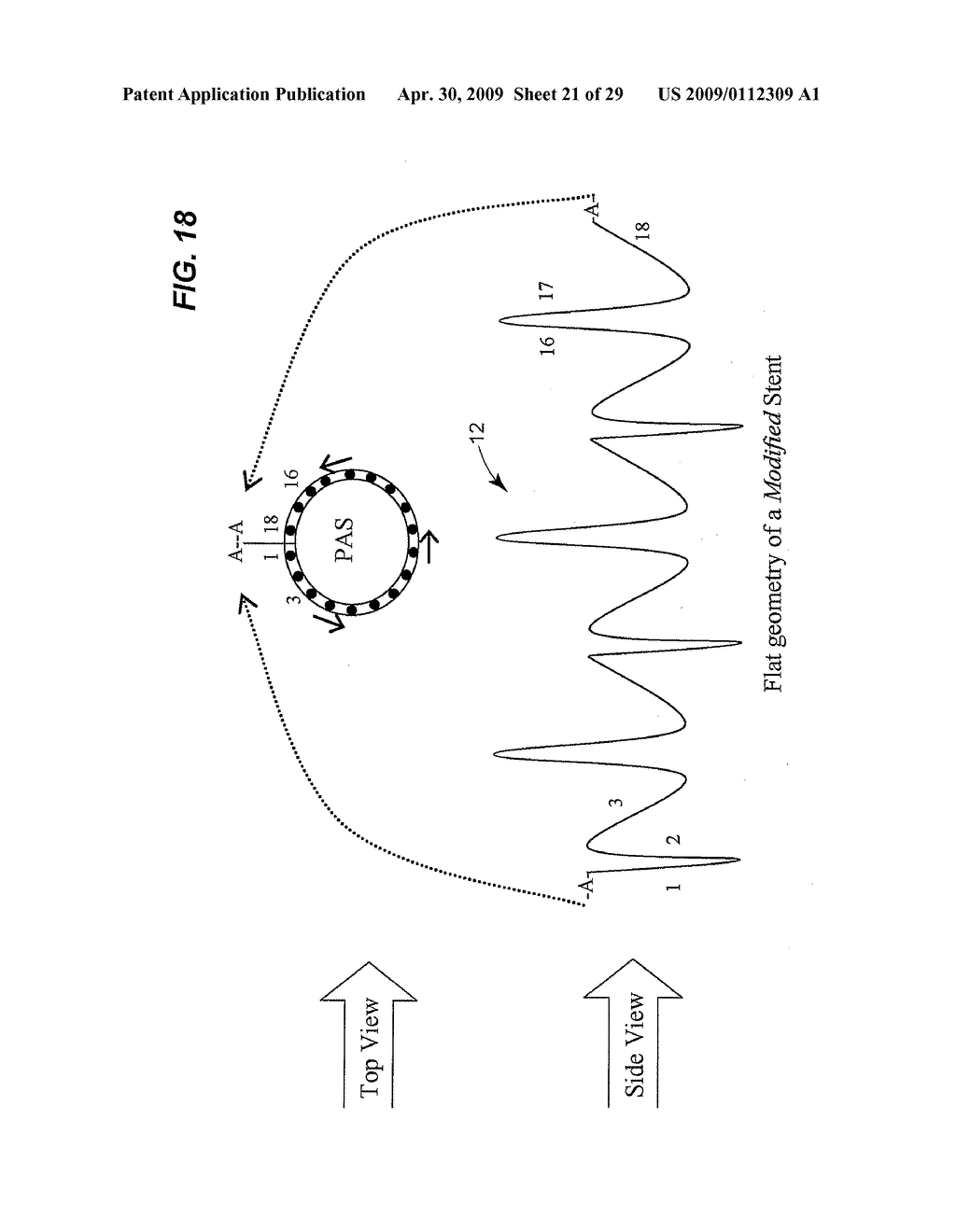 Collapsible Heart Valve with Polymer Leaflets - diagram, schematic, and image 22