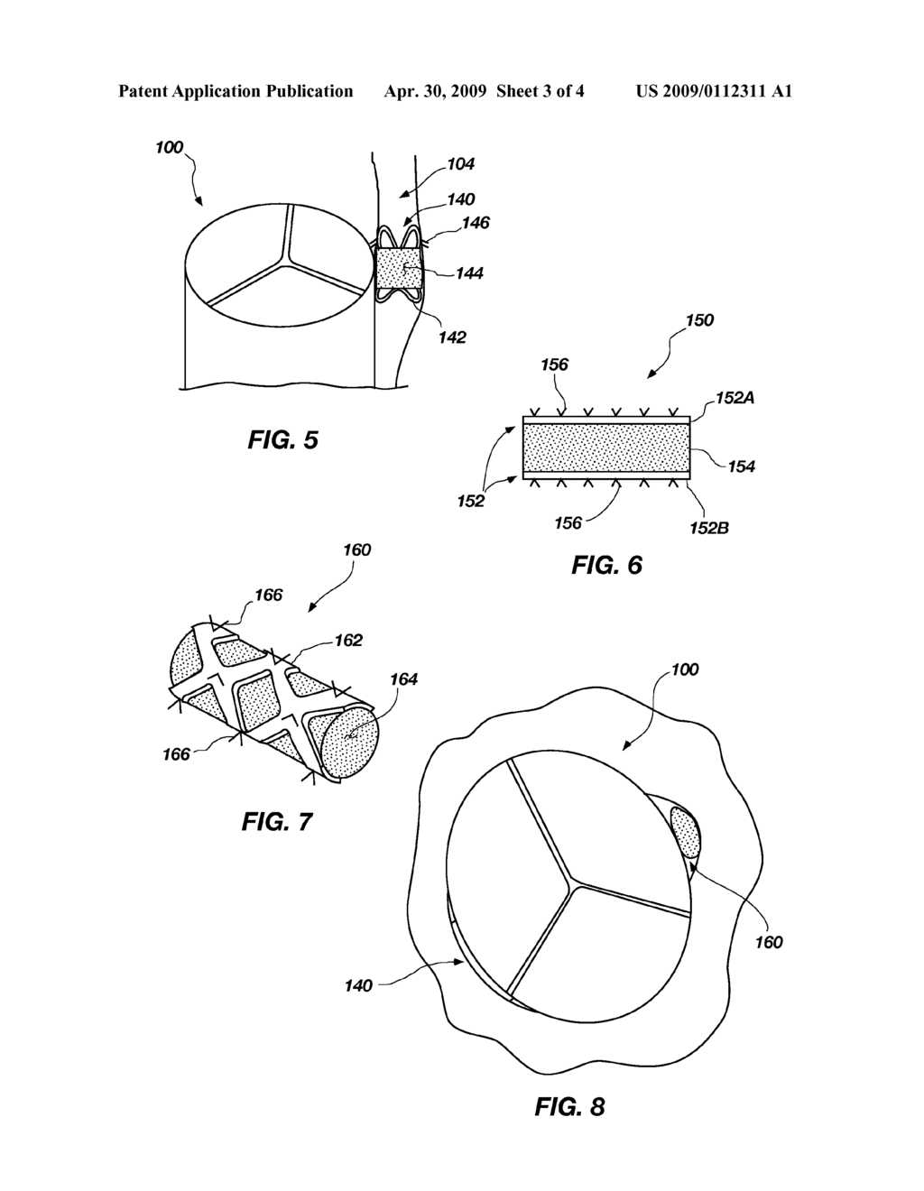 MEDICAL DEVICE FOR PERCUTANEOUS PARAVALVULAR LEAK AND RELATED SYSTEMS AND METHODS - diagram, schematic, and image 04