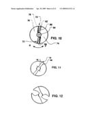 Intravascular ventricular assist device diagram and image