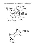 Intravascular ventricular assist device diagram and image