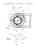 Intravascular ventricular assist device diagram and image