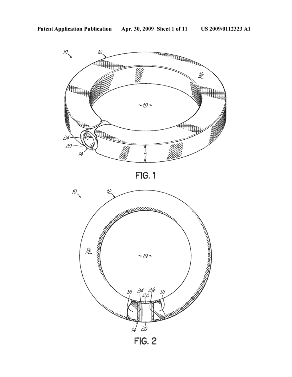 MINIMALLY INVASIVE INTERBODY DEVICE AND METHOD - diagram, schematic, and image 02