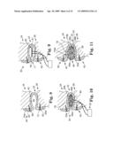 IN SITU ADJUSTABLE DYNAMIC INTERVERTEBRAL IMPLANT diagram and image