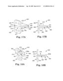 IN SITU ADJUSTABLE DYNAMIC INTERVERTEBRAL IMPLANT diagram and image